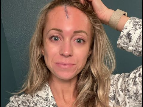 colorado rockies tv reporter kelsey wingert recovering after being struck in head by foul ball